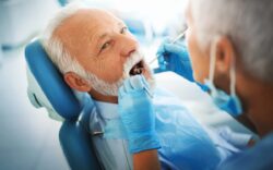 Affordable periodontitis treatment in Plano Texas